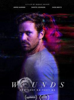 Wounds สัญญาณสั่งตาย